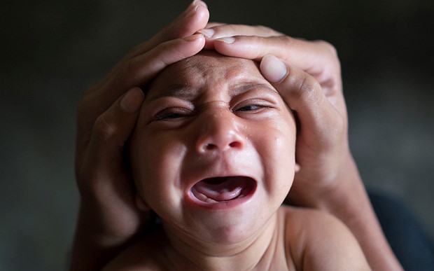 研究發(fā)現(xiàn)寨卡病毒誘發(fā)小頭癥的直接證據(jù)，但疫苗還是沒影｜美通社頭條